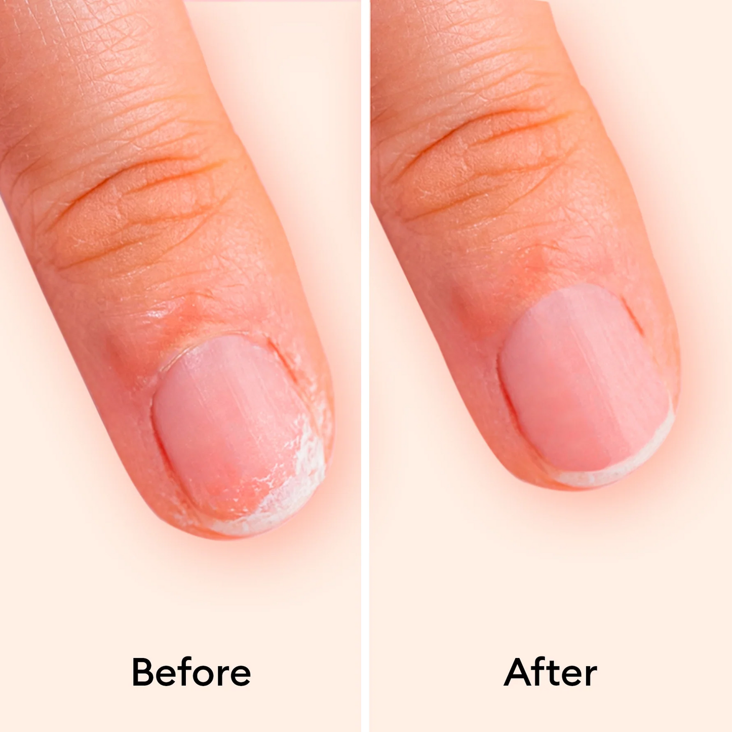 Nail Mask
